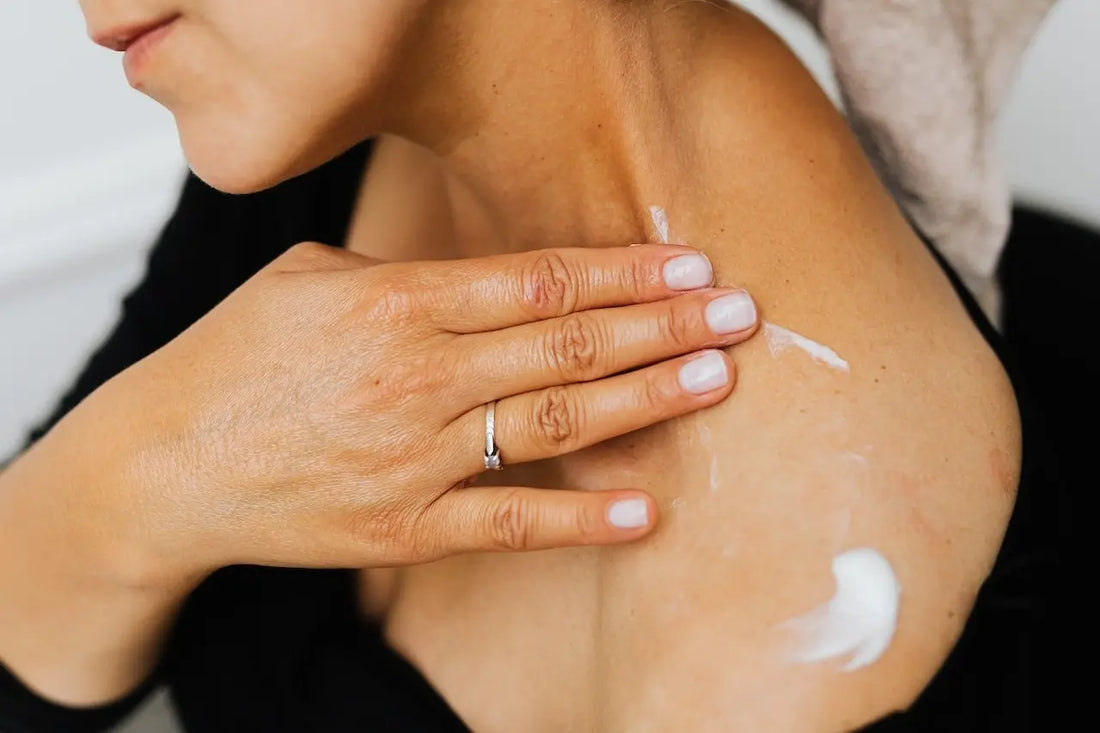 How to Know if Your Skin Barrier is Damaged