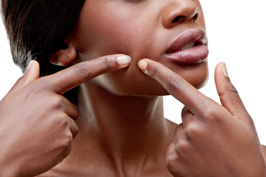 What is Skin Elasticity & How Can You Improve It?